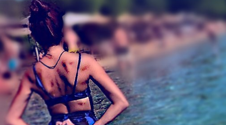 Επώνυμη Κύπρια μας δείχνει τη σέξι πίσω όψη της ποζάροντας με μπικίνι στις καλοκαιρινές της διακοπές!