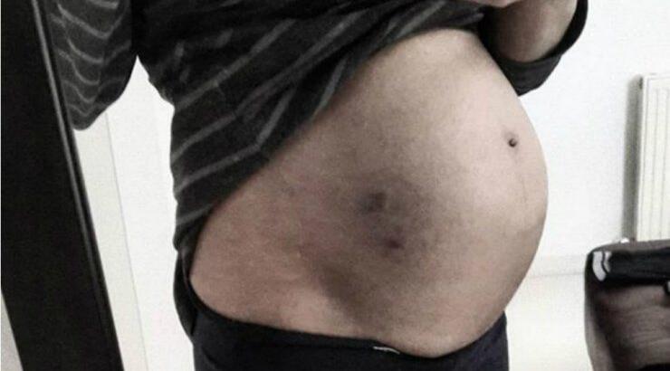 Η σύζυγός επώνυμου Κύπριου σοκάρει με όλα όσα είπε για το πρόβλημα που αντιμετώπισε στην εγκυμοσύνη της