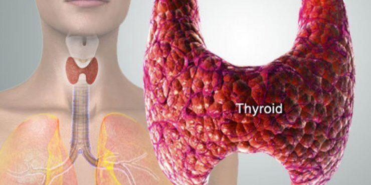 4η στην Ευρώπη σε καρκίνο του θυρεοειδούς η Κύπρος