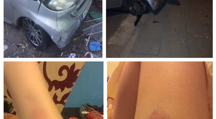 Το τρομακτικό ατύχημα για επώνυμη Κύπρια στη Λευκωσία και τα τραύματα σε όλο της το σώμα!