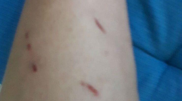 Ο τραυματισμός Κύπριας ηθοποιού μετά από επίθεση! 