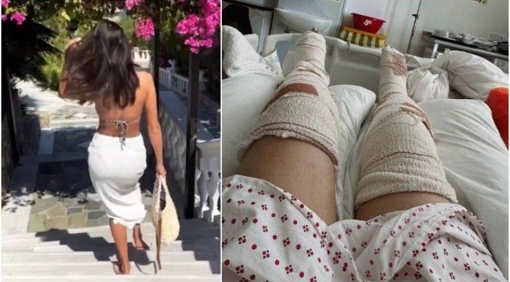 Συγκλονιστικές εικόνες Κύπριας tv personas: 35 εβδομάδων έγκυος με σπασμένα πόδια - Νεκρή η μητέρα της