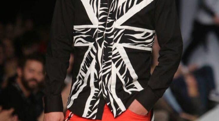 Έλληνας τραγουδιστής αποκαλύπτει: “Πάσχω από αλωπεκία. Στα 11 μου έχασα όλα τα μαλλιά μου”