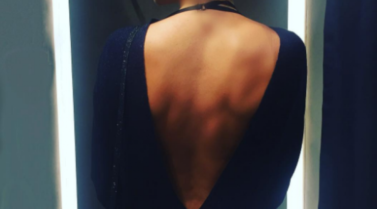 Ακομπλεξάριστη! Επώνυμη Ελληνίδα έκανε μπότοξ και το έδειξε στο instagram!