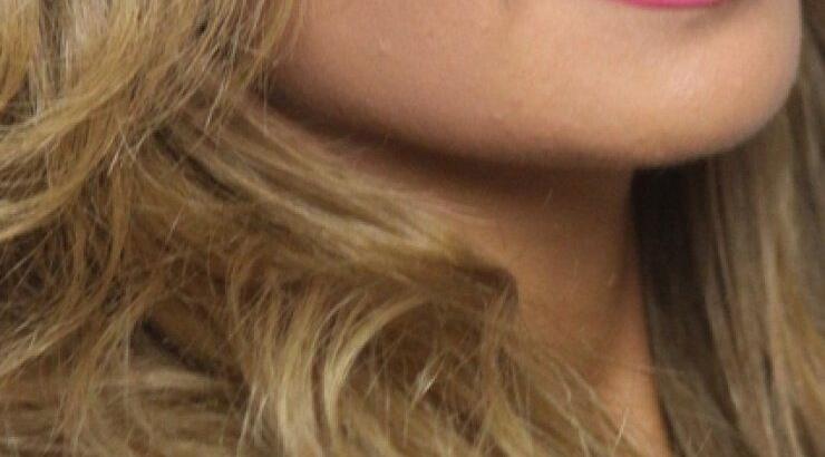 Ελληνίδα τραγουδίστρια παραδέχεται ότι έκανε πλαστική στήθους!