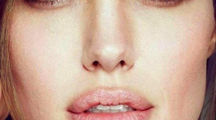 Garbon Peel: Δοκιμάσαμε τη θεραπεία των celebrities [βίντεο]