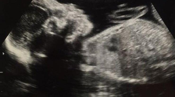 Έμαθαν το φύλο του μωρού τους και ανακοίνωσαν το όνομα μαζί με τον υπέρηχο