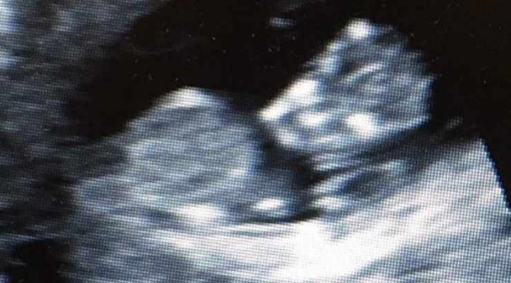 Ποιος επώνυμος θα γίνει μπαμπάς για δεύτερη φορά;