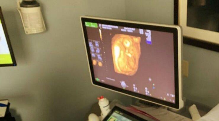 Ευχάριστα νέα στη showbiz! Γνωστό μοντέλο έγκυος για δεύτερη φορά! 