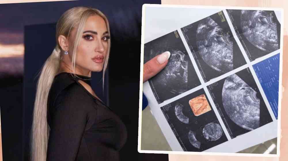 Τούνη: Ο υπέρηχος στον γυναικολόγο και τα 1000 μηνύματα που έλαβε σε ένα λεπτό [εικόνες]